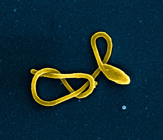 Wirus Eboli pod mikroskopem